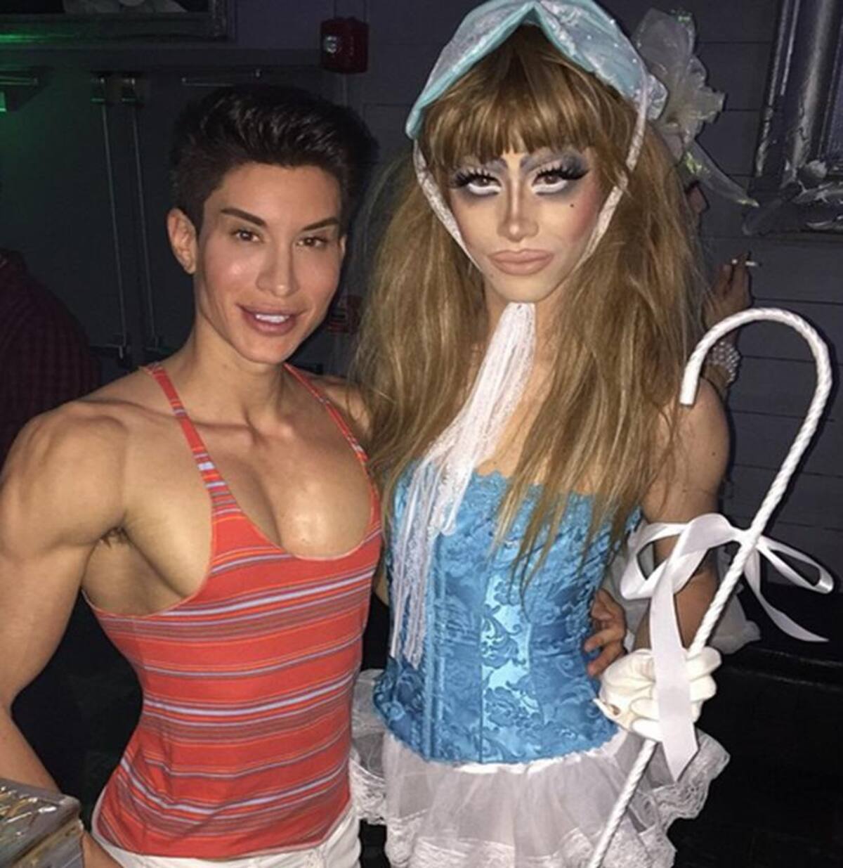 Justin Jedlica se operó para remover tres venas de su frente, intervención que lo pudo dejar ciego. Fotos: Instagram.
