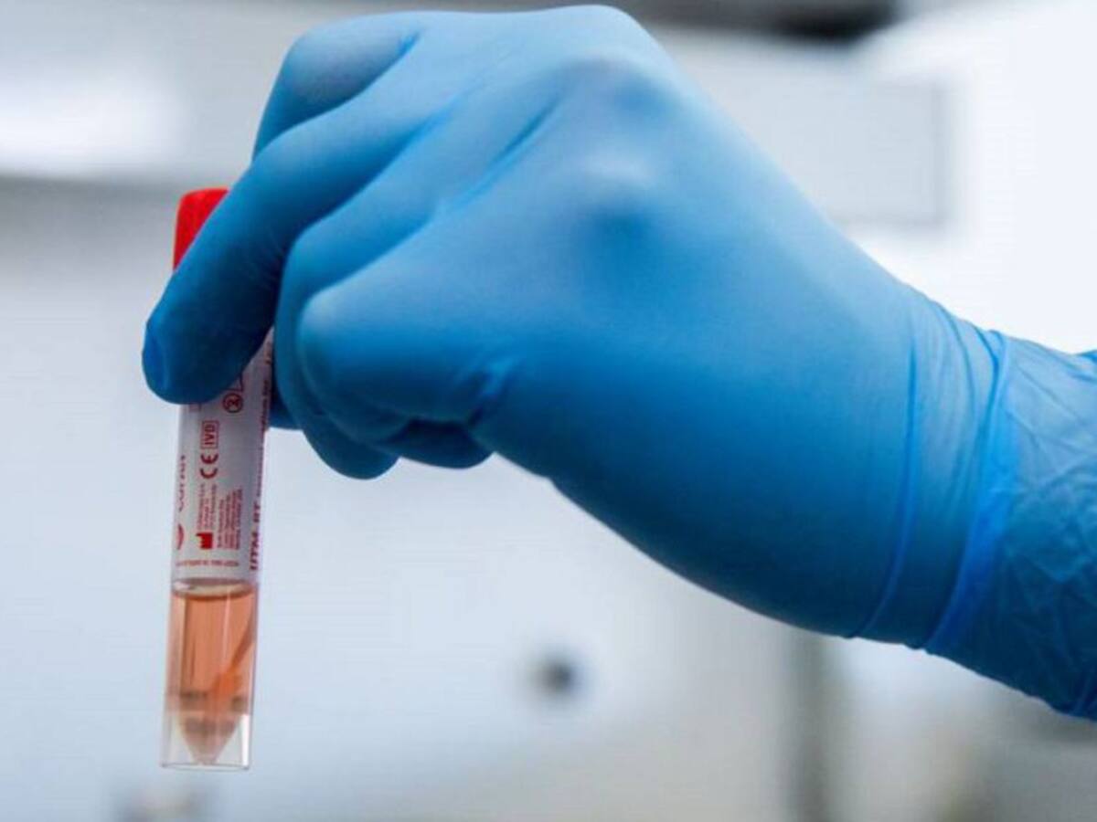 Confirman primer caso de la variante Ómicron en el Quindío