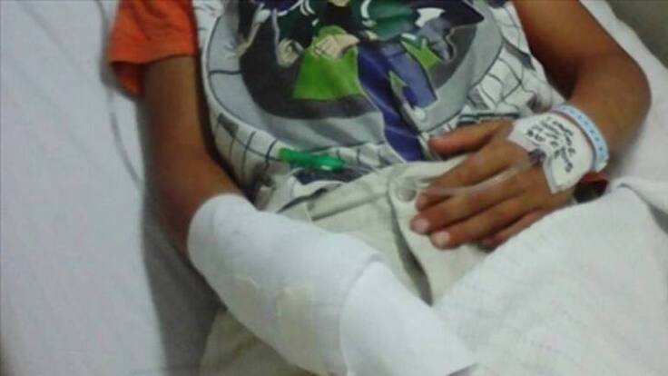 Nueve personas quemadas con pólvora en Quindío en lo que va de diciembre