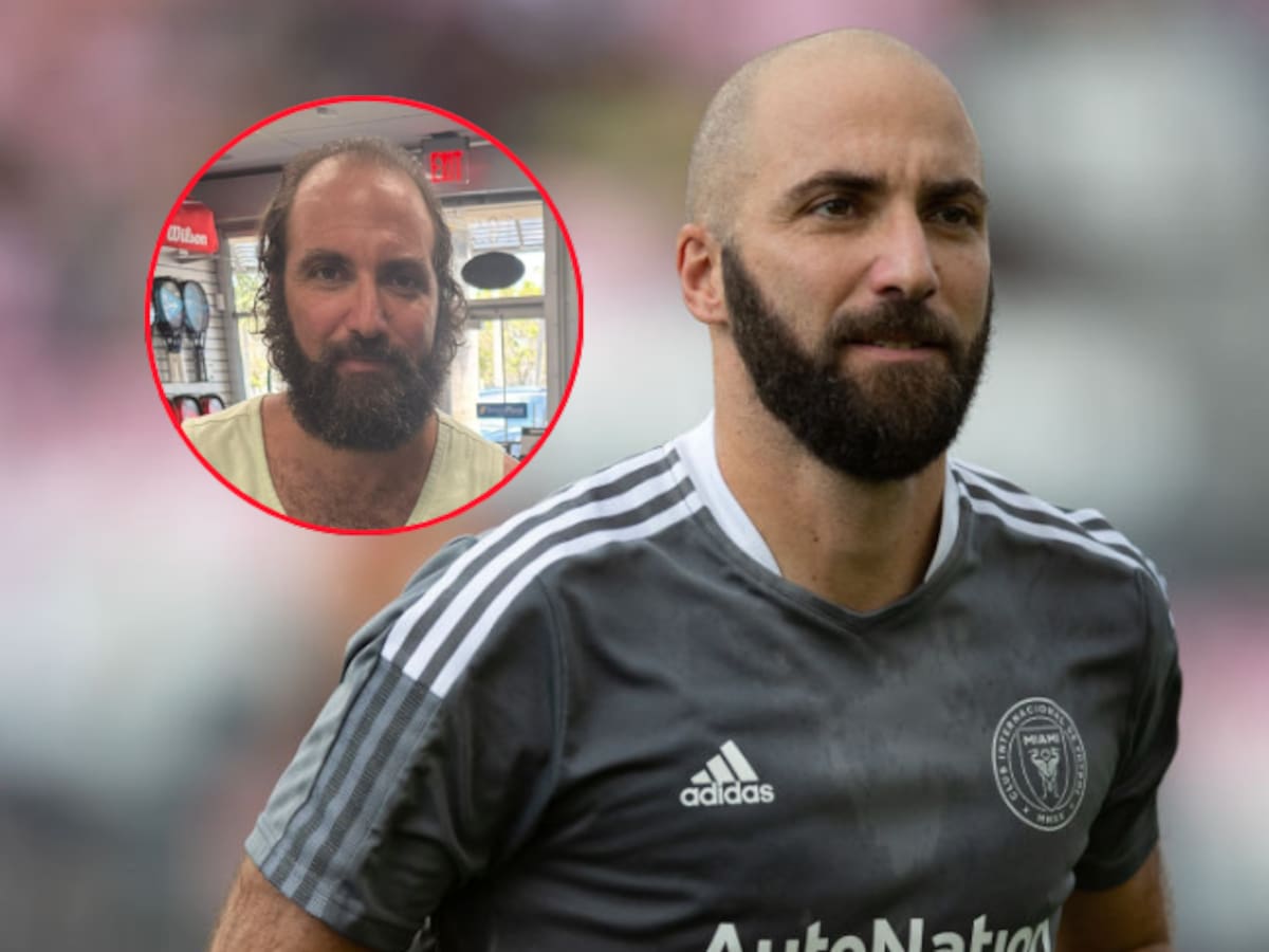 Así luce hoy el Gonzalo Higuaín: Esta es la fotografía del exfutbolista que se hizo viral
