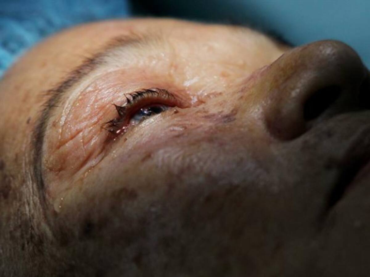 Listo proyecto de ley para regular cirugías estéticas en el país