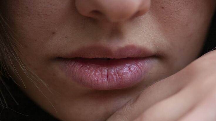 ¿Cómo es la vida de los pacientes con psoriasis?