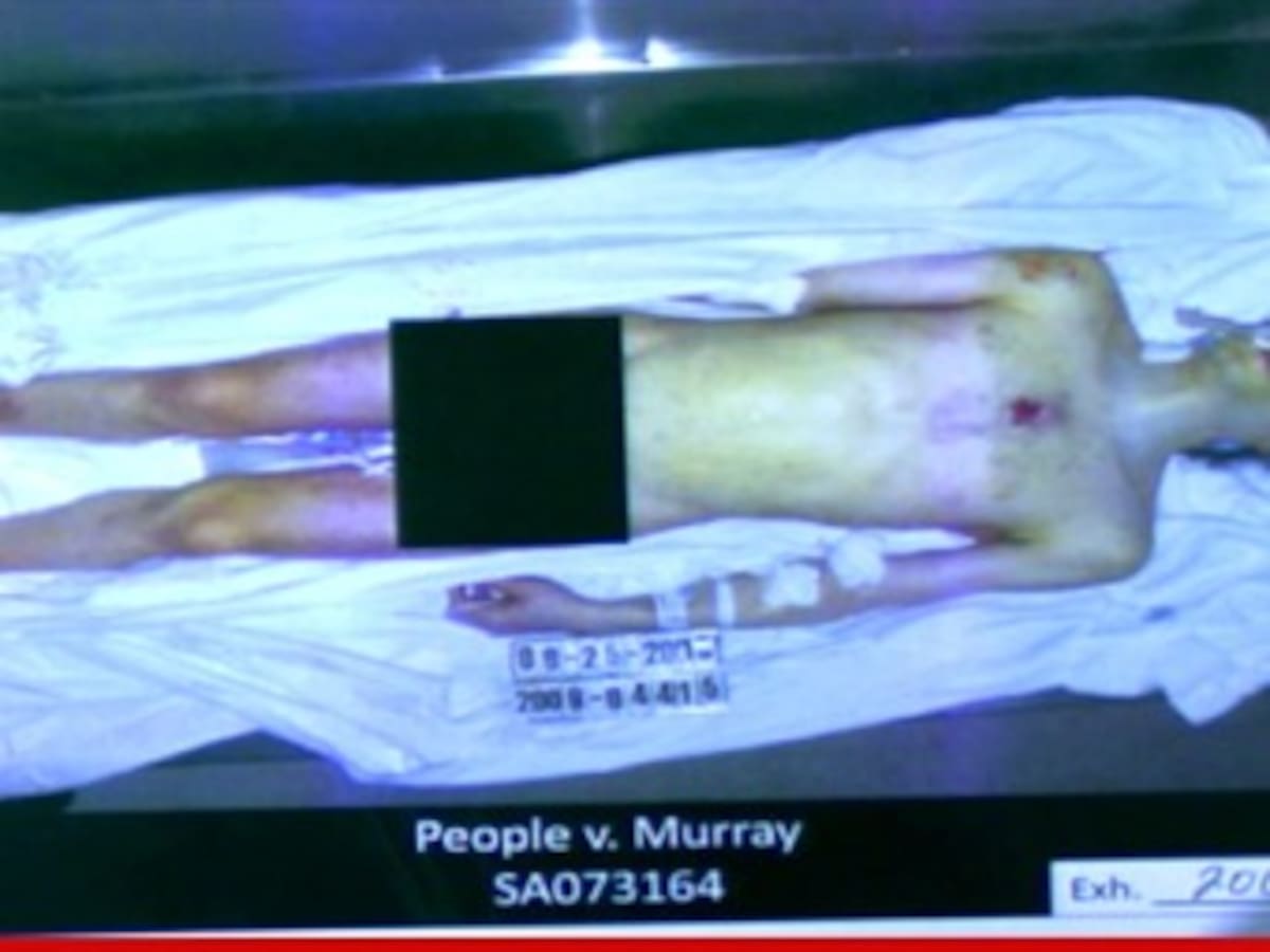 Jackson no provocó su propia muerte: forense