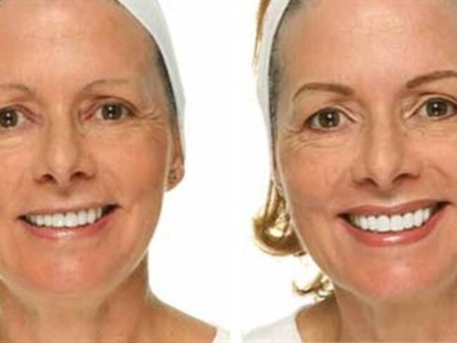 Micropigmentación: el tatuaje que embellece y ayuda