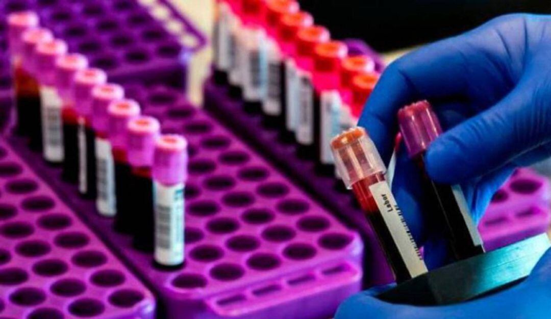 Siete de los ocho de casos confirmados de Covid - 19 están en Armenia