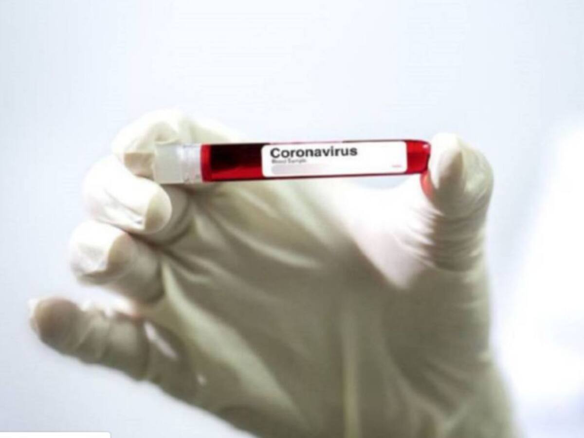 Territorial de Salud busca aumentar las muestras diarias de COVID-19