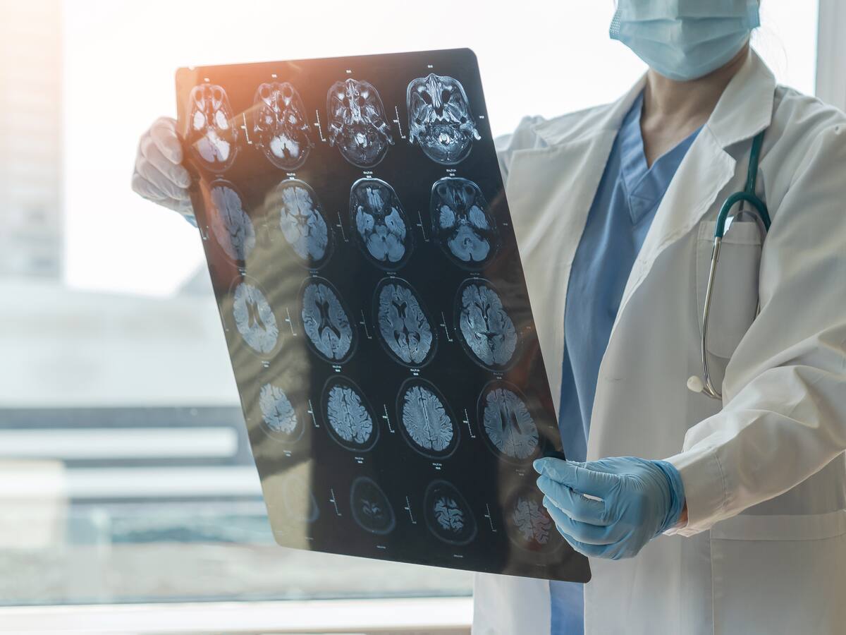 Realizar este ejercicio por seis minutos al día reduciría el riego de padecer Alzhéimer