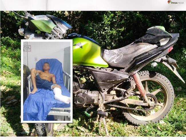 El hombre resultó con un pie fracturado y laceraciones en su cuerpo.