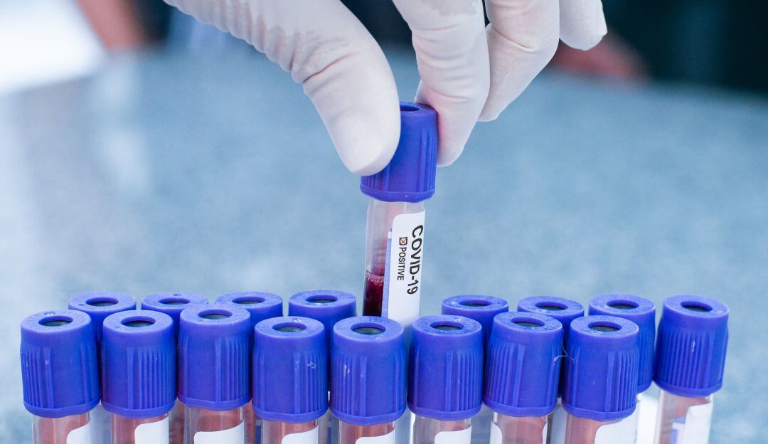 Imagen de referencia