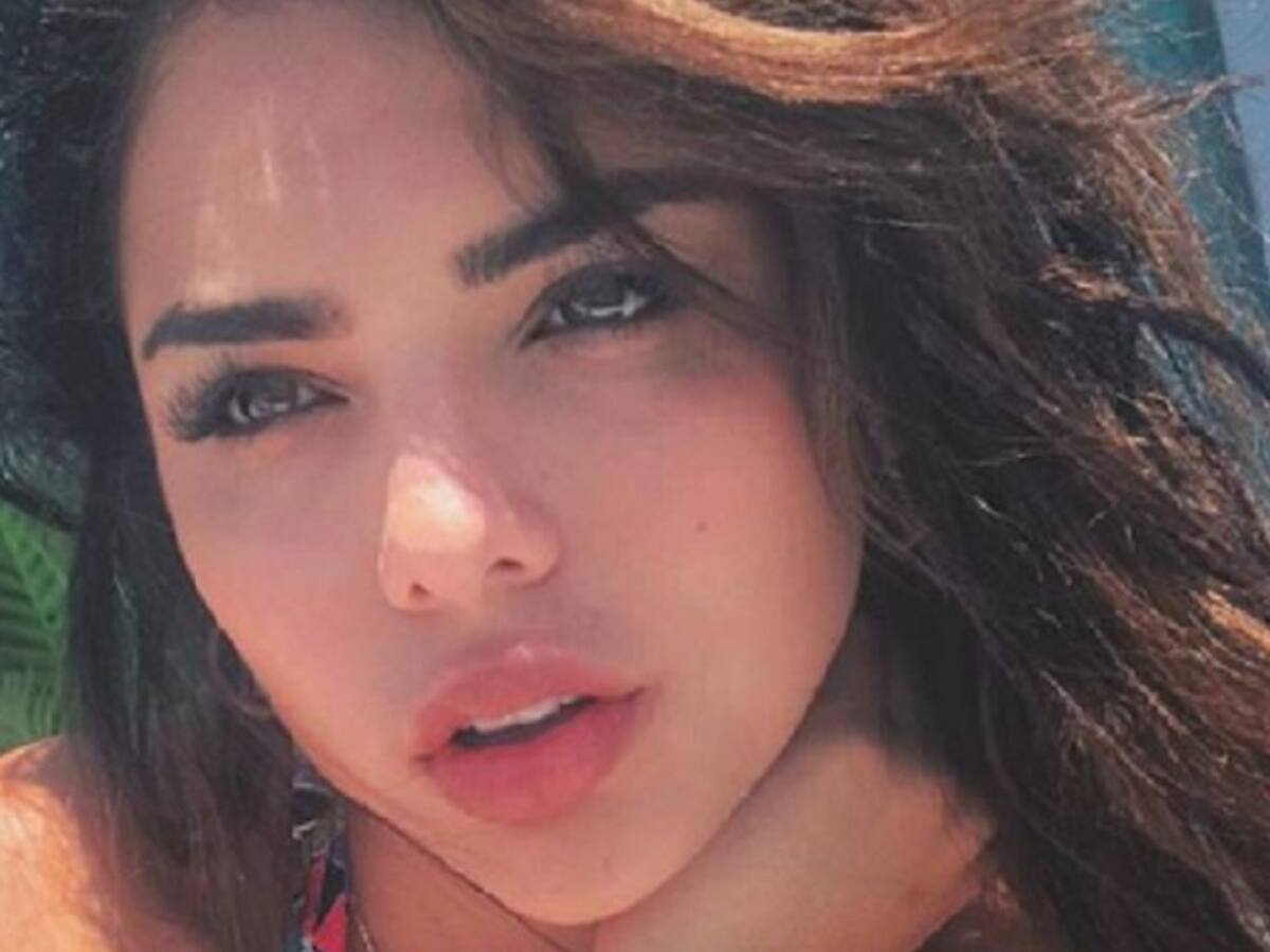 Conozca la verdad sobre los labios de la hermana de James Rodríguez