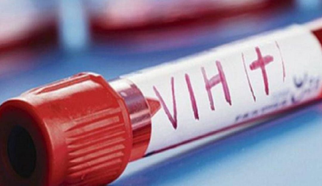 En el Huila se reportan 307 casos de VIH.