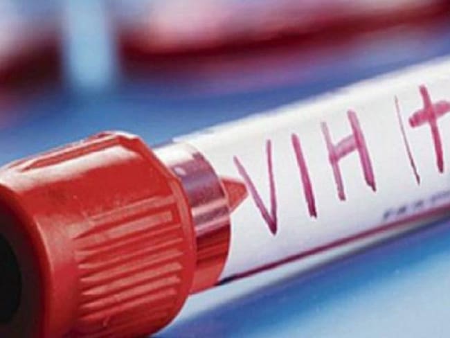 En el Huila se reportan 307 casos de VIH.