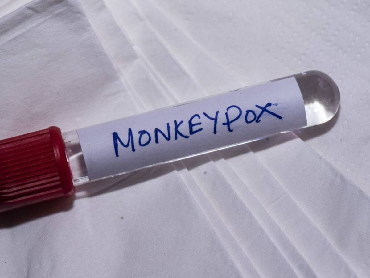 Viruela del mono en Colombia hoy: número de casos actualizado