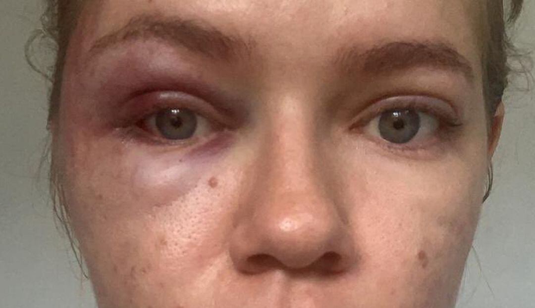 Investigan a concejal Deiby Arias por caso de maltrato intrafamiliar en Ocaña / Foto Archivo