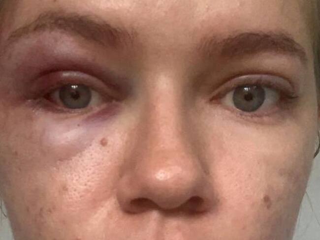 Investigan a concejal Deiby Arias por caso de maltrato intrafamiliar en Ocaña / Foto Archivo