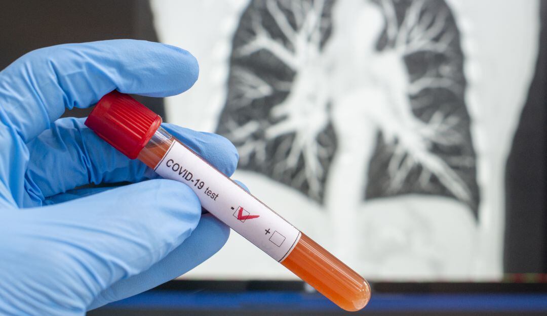 Pruebas de Covid-19