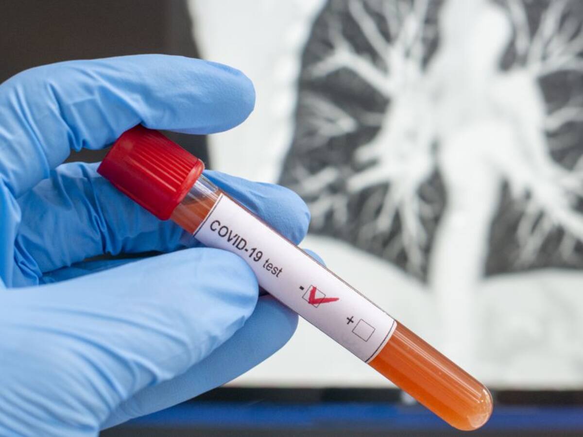 Coronavirus en Colombia: 1.931 casos nuevos y 52 fallecidos