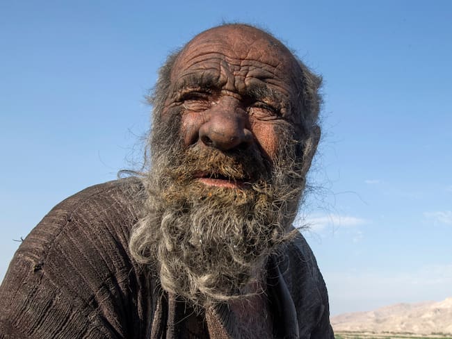 Amou Haji, considerado el hombre &quot;más sucio del mundo&quot; / AFP