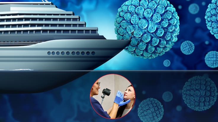 ¿Qué tan preocupante es el brote de hantavirus detectado en un crucero? Médico explica