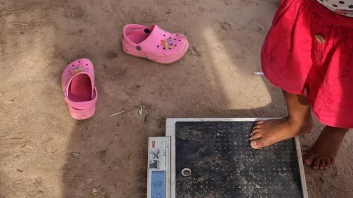 Crean mesas de salud para atender situación de desnutrición infantil en Risaralda