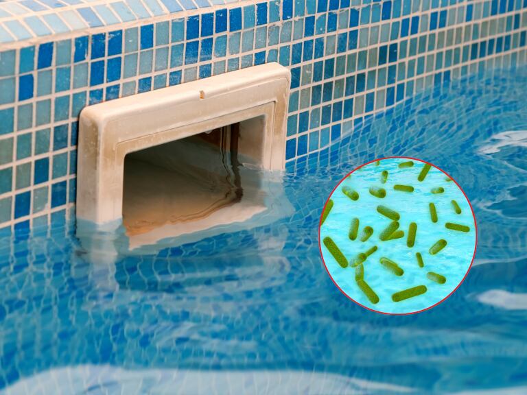 Qué pasa si entra a una piscina sucia: Doctor explica las infecciones más comunes que podría contraer (Getty Images)