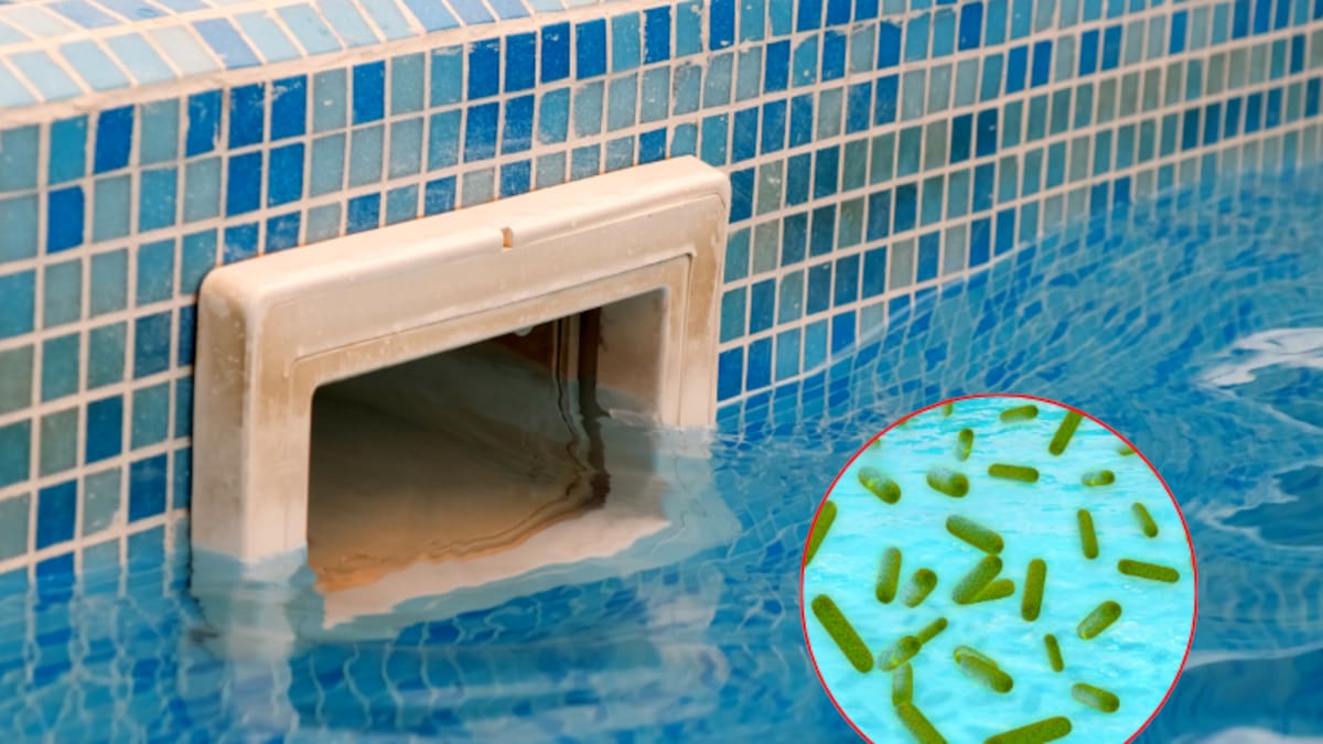 Qué pasa si entra a una piscina sucia: Doctor explica las infecciones más comunes que podría contraer
