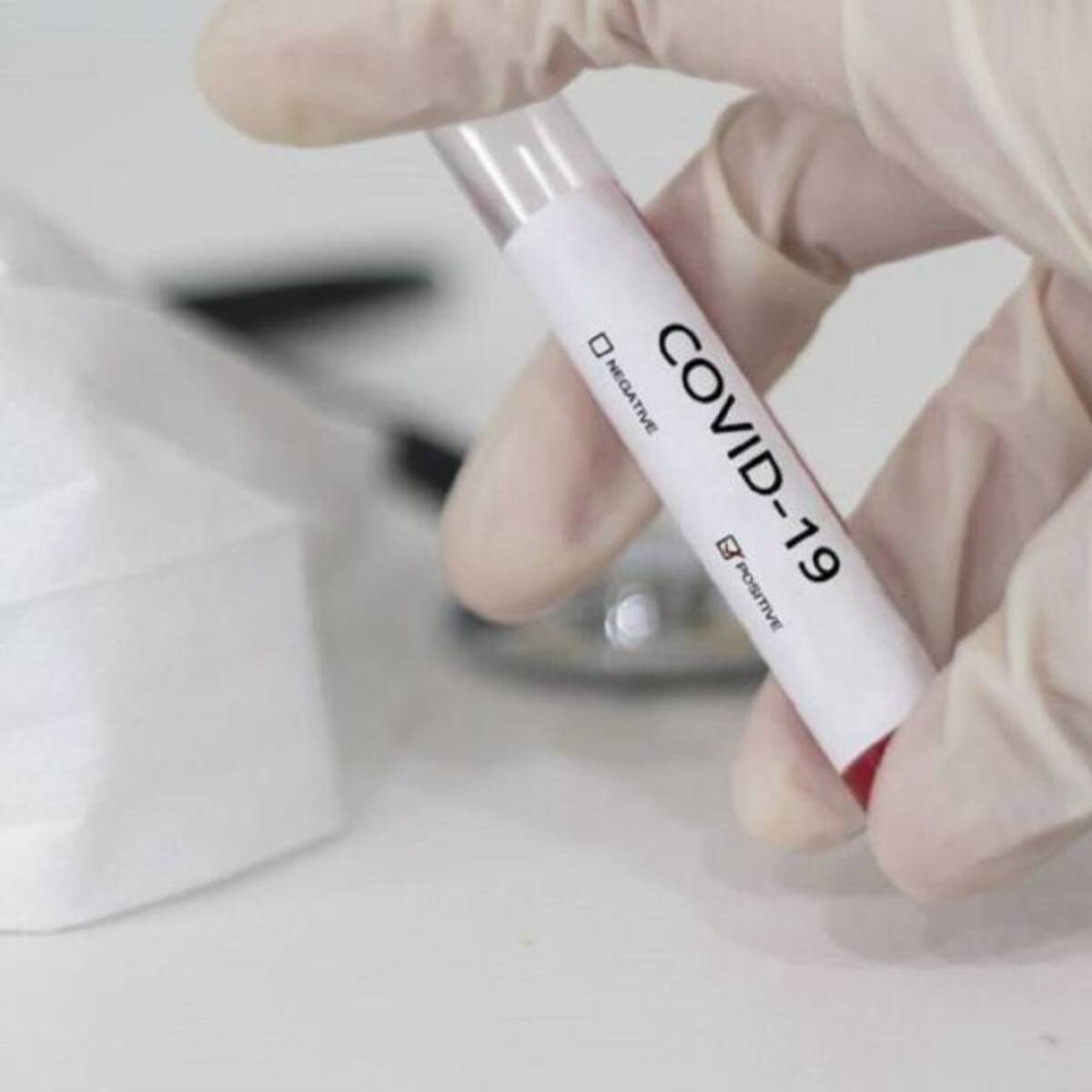 La contagiosidad por COVID-19 ha incrementado en un 30% en el Quindío