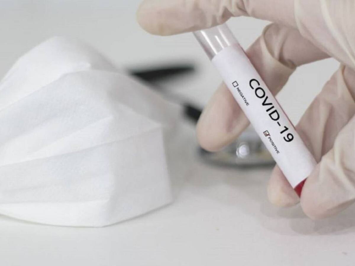 La contagiosidad por COVID-19 ha incrementado en un 30% en el Quindío