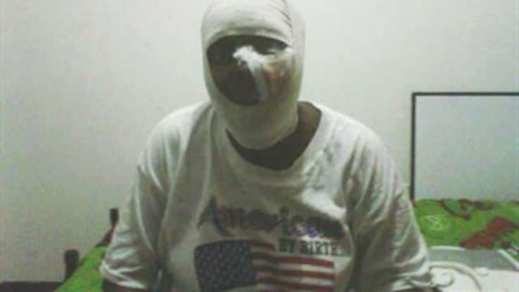 La esperanza de Consuelo: que el hombre que le desfiguró la cara, la vea por TV