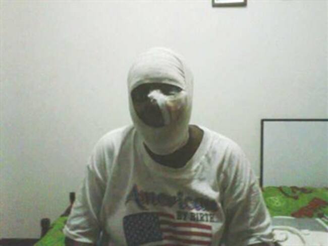 La esperanza de Consuelo: que el hombre que le desfiguró la cara, la vea por TV