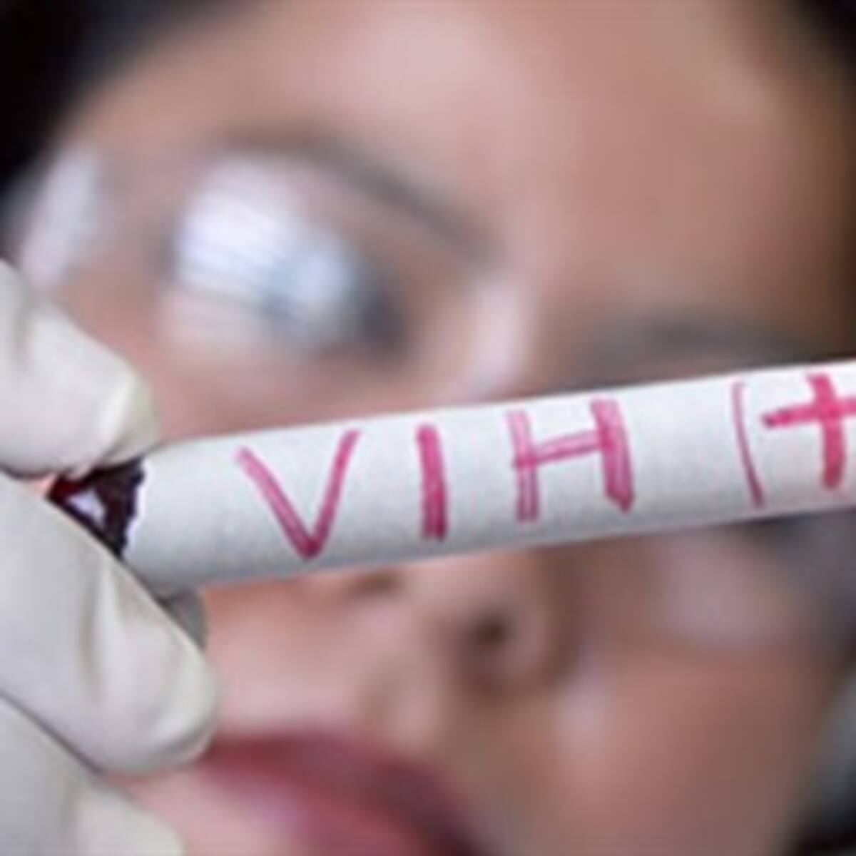 Pacientes con VIH deben tener cuidado con su alimentación