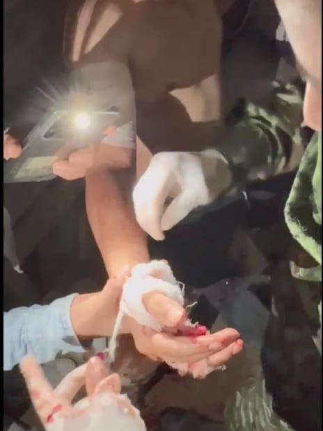 Menor herido en Briceño por un militar ebrio- foto Cuarta Brigada