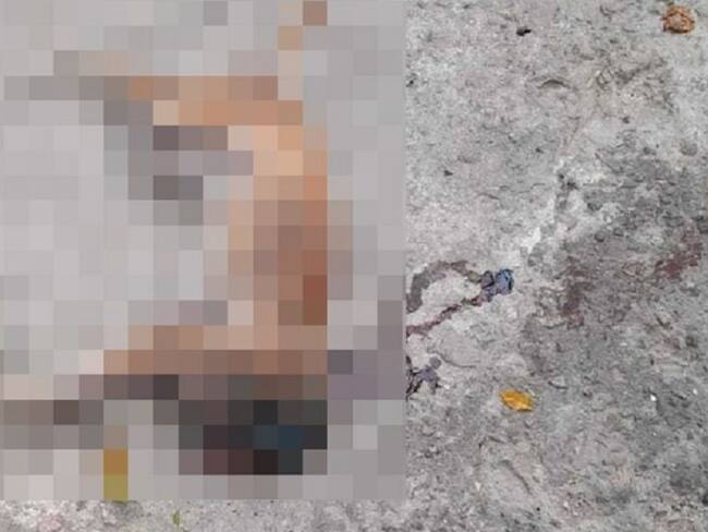Alias el “guerrillero” le cortó la cabeza a un perro en Bucaramanga