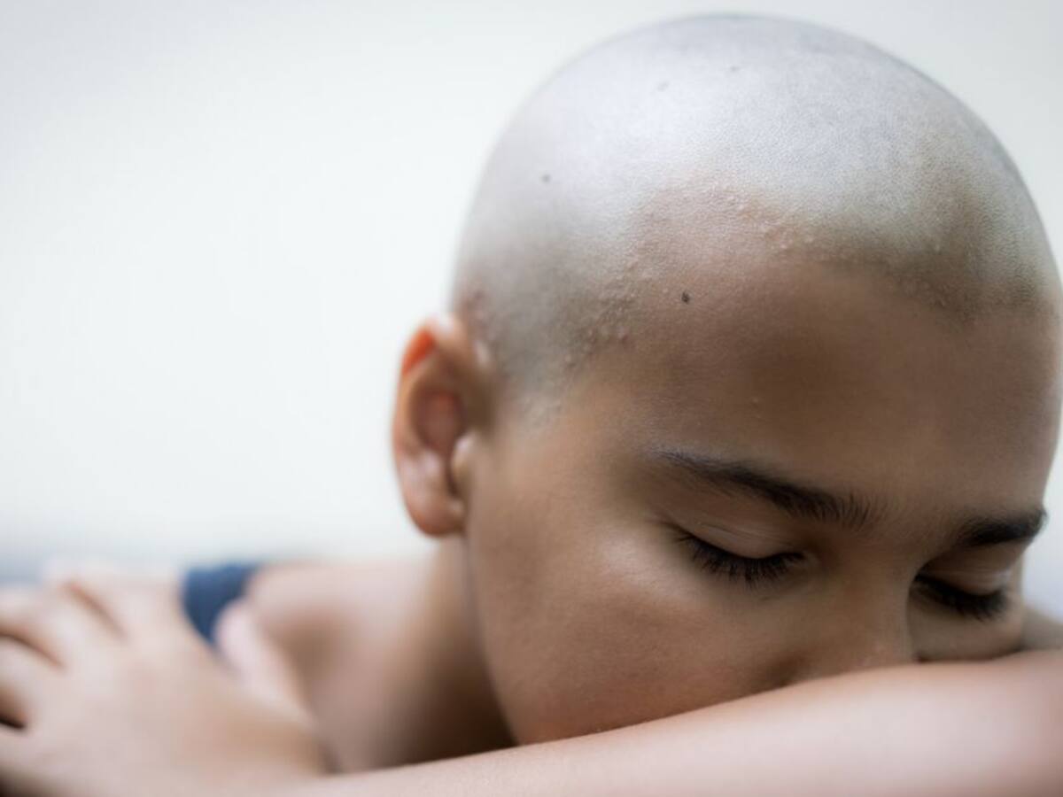 Ojo: El cáncer afectaría a más de 108.000 personas en Colombia durante 2020