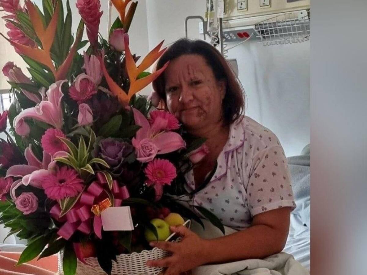 A juicio líder social que en Tunja habría fingido ataque con ácido