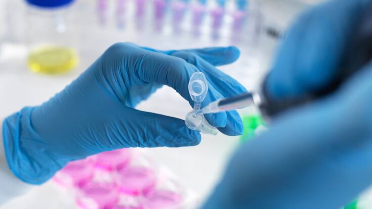 ¿Qué son las células madre y cómo donarlas para salvar vidas?