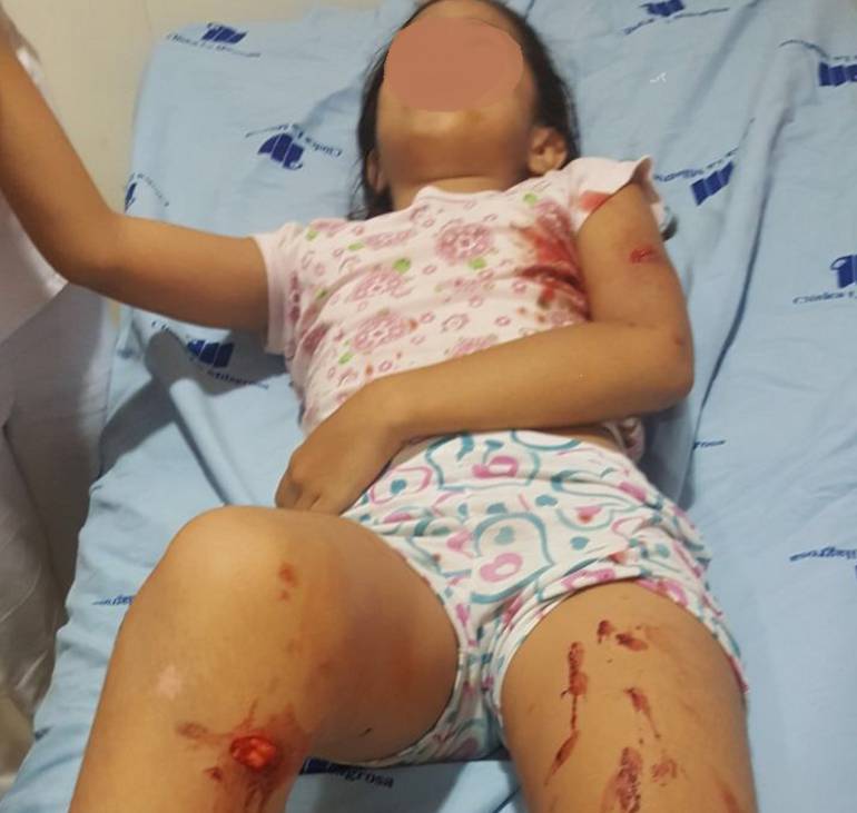 Fotografía autorizada por los padres de la menor.