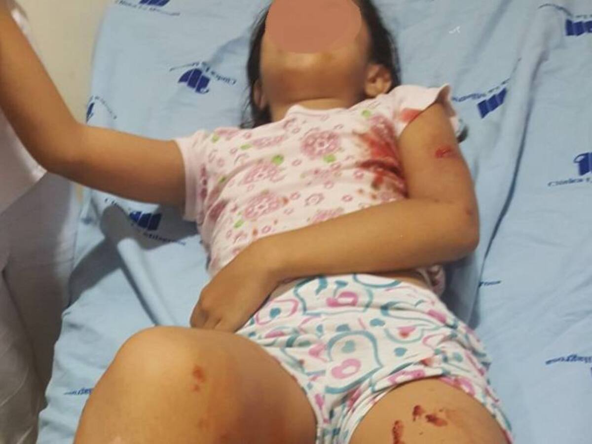 Perro mordió nueve veces a una niña en Santa Marta