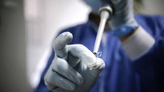 El número de personas fallecidas por COVID-19 en Cartagena desde que inició la pandemia aumentó a 2.163