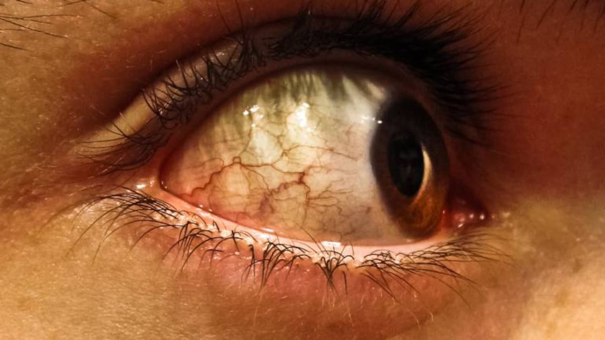 EMDR, una psicoterapia que permite volver al pasado