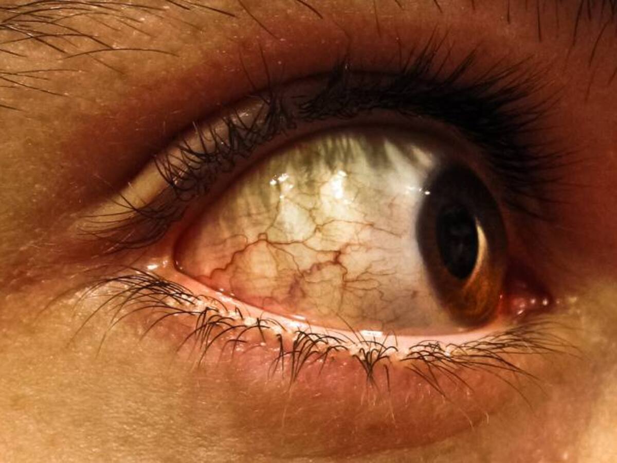 EMDR, una psicoterapia que permite volver al pasado