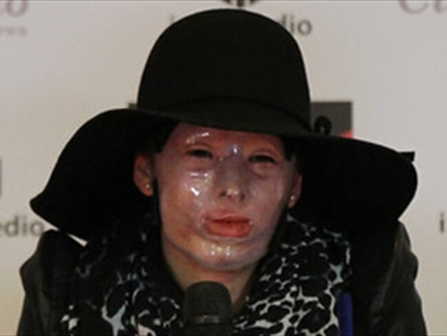 Natalia Ponce presenta libro sobre su drama tras ser atacada con ácido