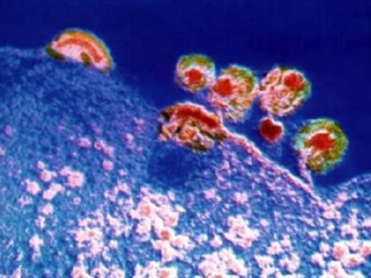 Cuatro años de cárcel por ocultar que tenía sida y contagiar a su compañera