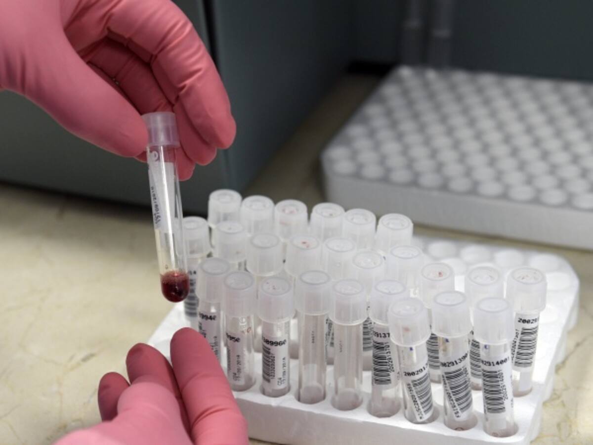 Nueva esperanza para portadores de VIH