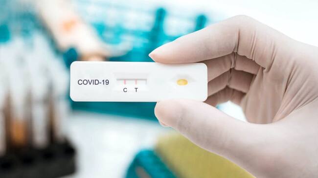 Más de 18 mil pruebas de antígenos Covid se realizan a diario en el Huila.