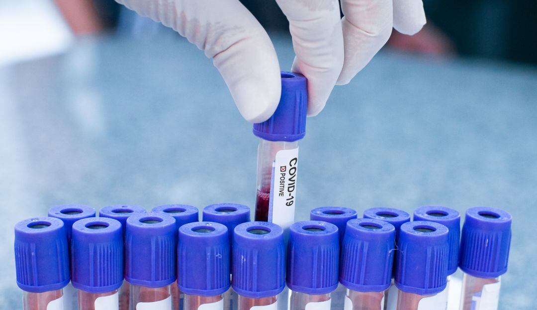 Imagen de referencia