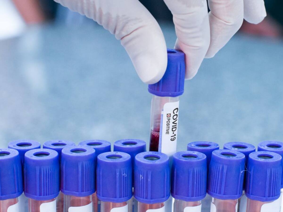 Reportan 50 quejas diarias contra EPS por demoras en pruebas de COVID-19