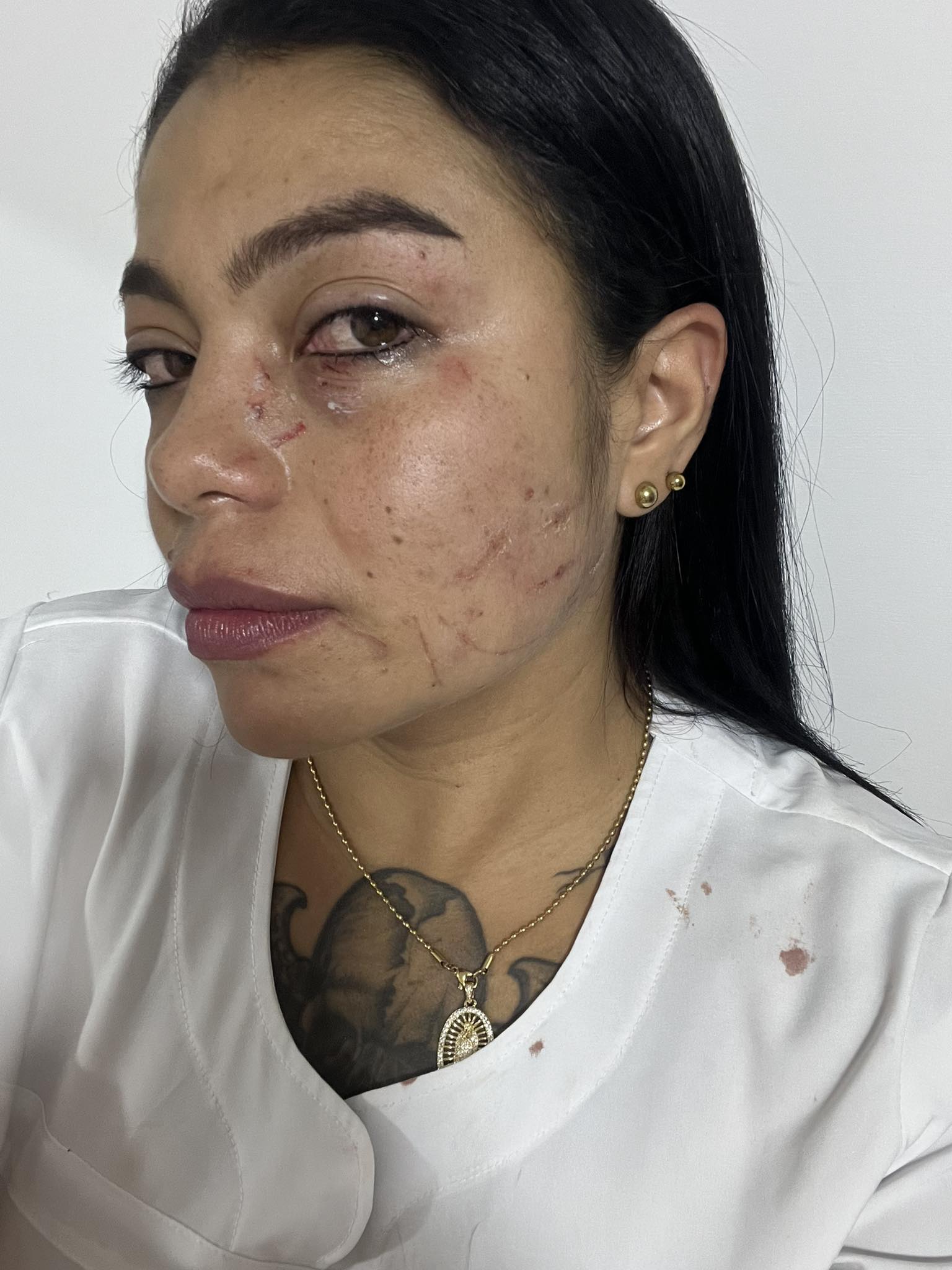 Enfermera agredida en Ciudad Bolívar- foto tomada de Facebook