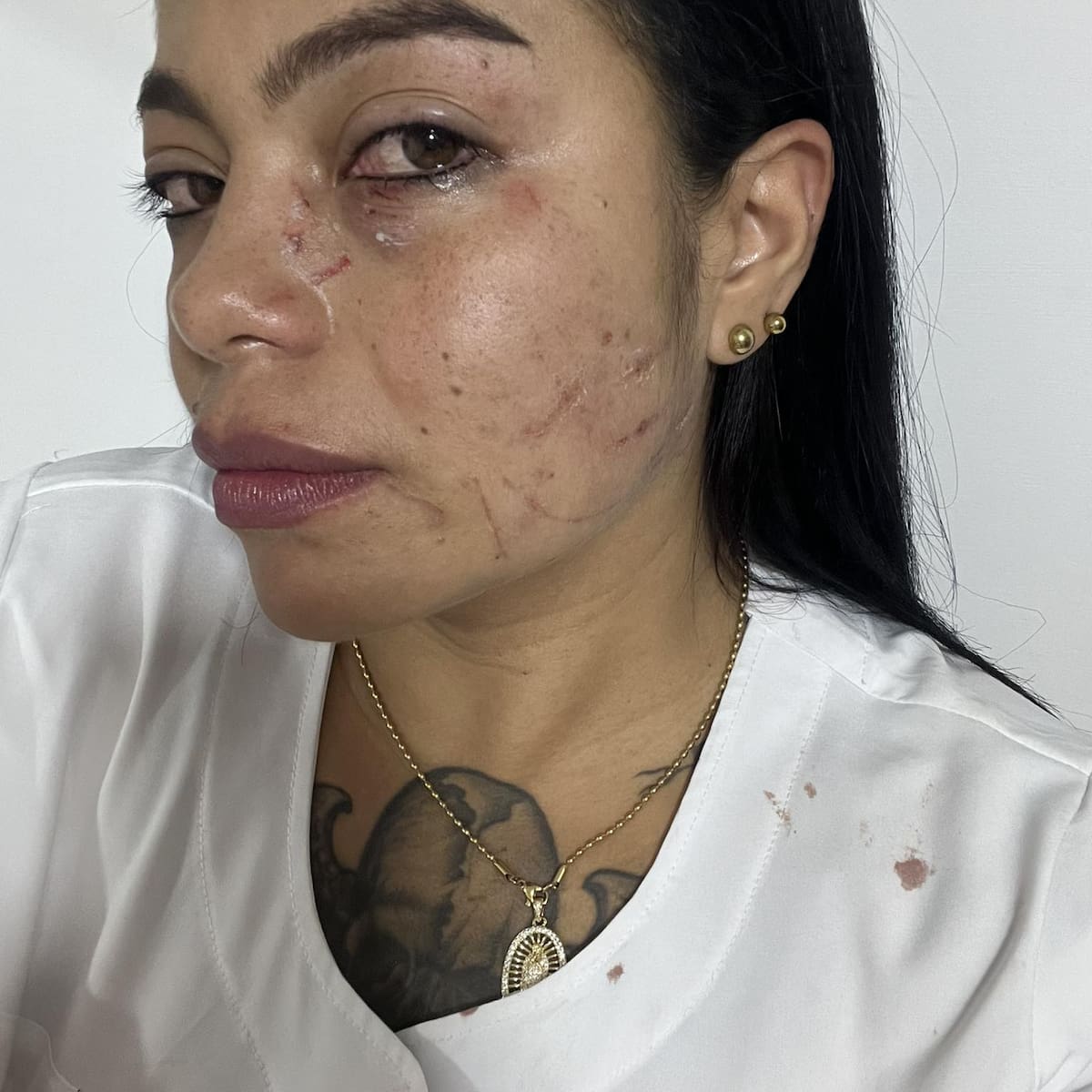 Una mujer agredió a una enfermera en el hospital La Merced de Ciudad Bolívar, Antioquia