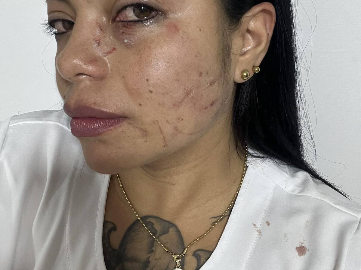 Una mujer agredió a una enfermera en el hospital La Merced de Ciudad Bolívar, Antioquia